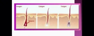 Business 3 image ELITE LASER Hair Removal in Birmingham We