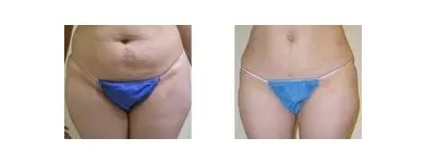 Business 1 image SKINDEEP LASER & BEAUTY Electrolysis & Laser Hair Removal in Coventry We