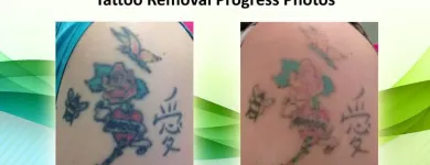 Business 5 image STROUDEN PARK BEAUTY CLINIC Tattoo Artists in Bournemouth Do