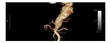 Business 3 image VASCULAR SURGERY LTD Medical Facilities in Wilmslow Ch